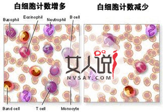 中性粒细胞百分比偏高是为什么?快来看看吧!