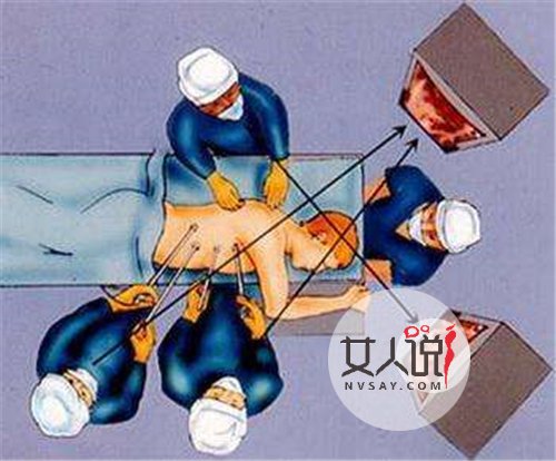 结核性胸膜炎怎么得的 大多病症与结核杆菌有着关系