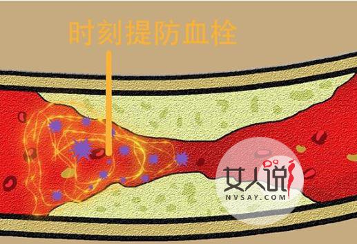 脑血栓前兆,可能知道某一个就救了你